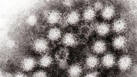 Partículas del norovirus
