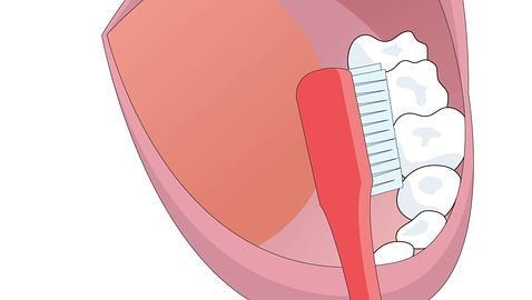 ¿Puede una buena higiene oral prevenir la enfermedad periodontal?