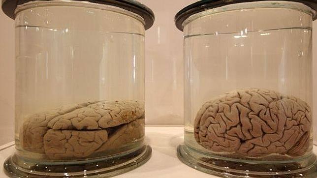 Resuelven la misteriosa desaparición de cerebros de la Universidad de Texas