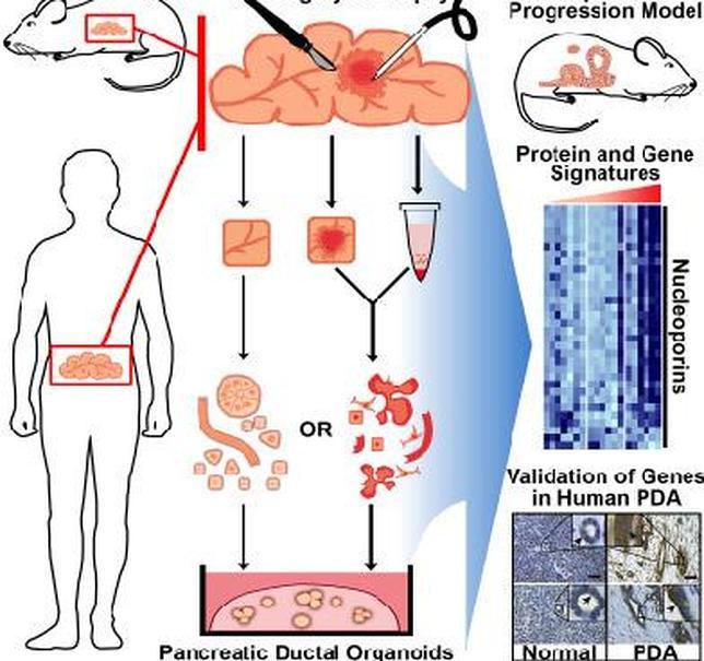 Fabrican organoides en 3D de células pancreáticas cancerosas