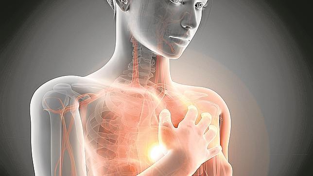 La hipertensión arterial es una de las causas de la insuficiencia cardiaca cuando al corazón le cuesta bombear