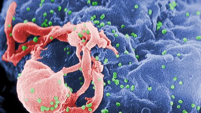 Virus del sida infectando una célula
