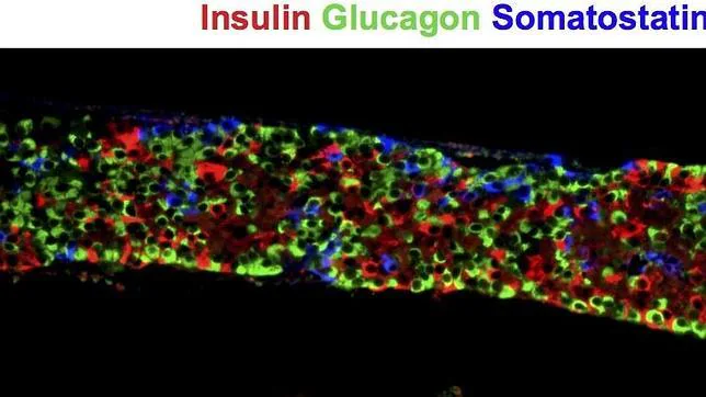 Imagen de las células endocrinas pancreáticas macro-encapsulado derivadas de células madre embrionarias humanas. Insulina (rojo), el glucagón (verde), y somatostatina (azul).