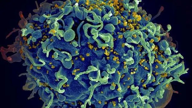 VIH infetando una célula inmune humana