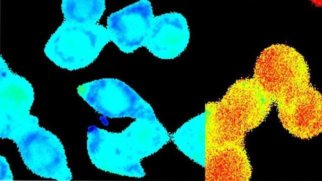 Un trabajo, publicado en la revista 'The Journal of Biological Chemistry', recoge por primera vez datos sobre la remodelación del calcio en el cáncer colorrectal