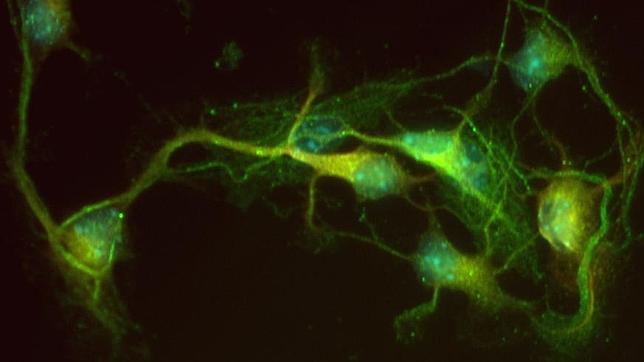 La transmisión de información entre las neuronas ocurre en la sinapsis