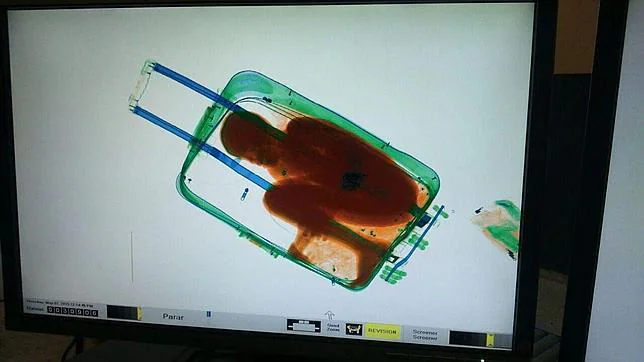 Imagen del menor dentro de la maleta a través de los rayos X