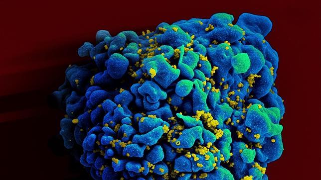 Descubren una clave para que las personas con VIH controlen la infección de forma natural