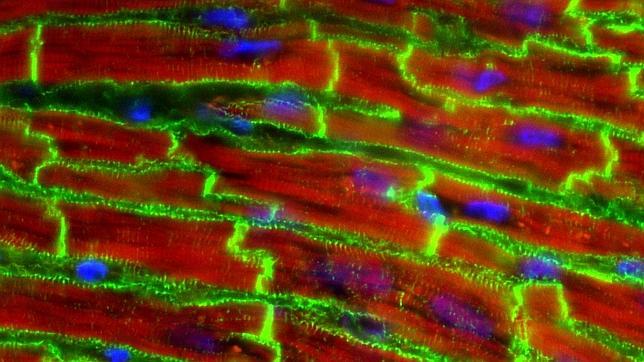 Células del músculo cardíaco de un ratón. La vinculina en verde