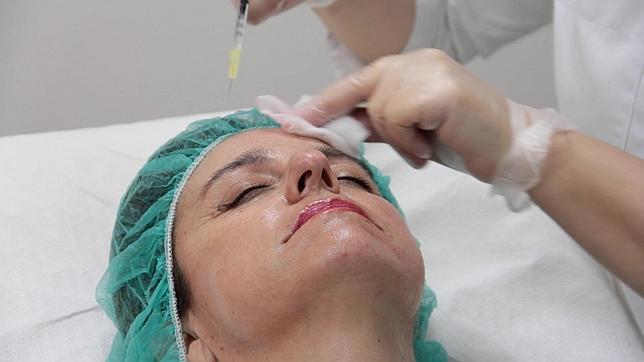 Lifting sin cirugía, la técnica más novedosa y natural para realzar el rostro