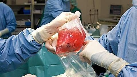 Imagen de un trasplante de riñón