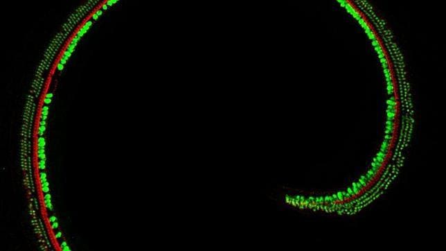 Células ciliadas sensoriales en la cóclea de un ratón Beethoven tratados con terapia génica TMC2. En esta imagen de microscopía confocal, se muestran microvellosidades en rojo y cuerpos celulares en verde. El oído humano tiene alrededor de 16.000 células ciliadas sensoriales
