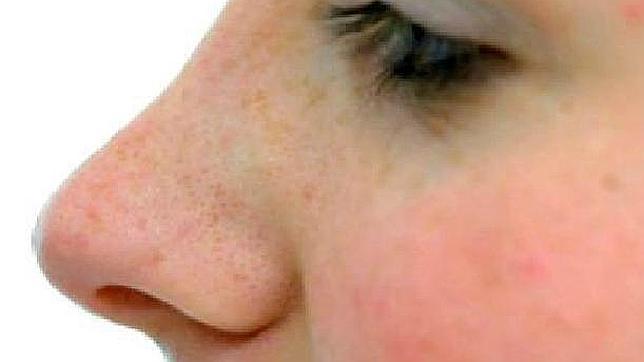 Las personas que no padecen problemas respiratorios durante el año, pueden sufrirlos en verano