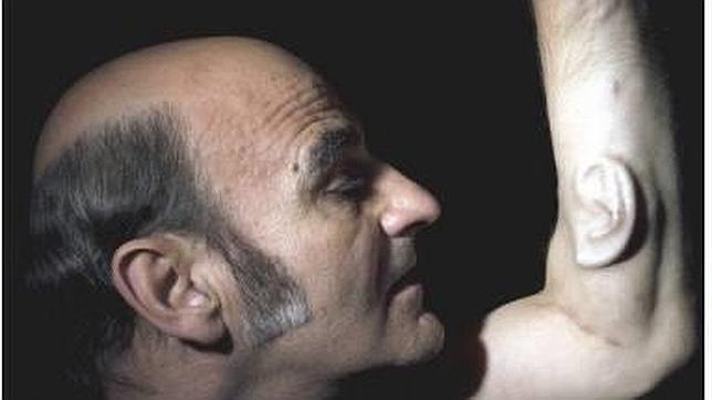 «Stelarc», con su tercera oreja