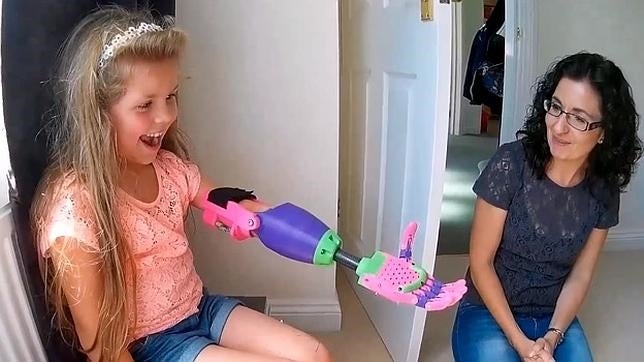 El emotivo momento en que una niña prueba su brazo impreso en 3D