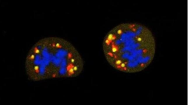 Células en división con el material genético en azul y las mitocondrias en rojo. Durante este proceso, las mitocondrias se van dañando (señales amarillas) haciendo que la energía de las células dependa sobre todo de la glucosa