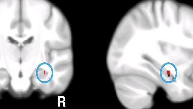 Descubren un grupo de genes claves en mantener la memoria y en el alzhéimer