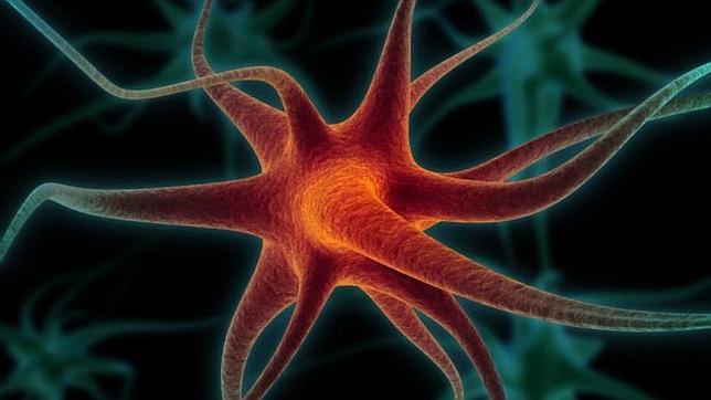 La inflamación estimula la formación de placas amiloides