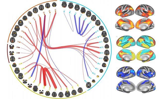 Las personas con rasgos positivos tienen conexiones cerebrales diferentes