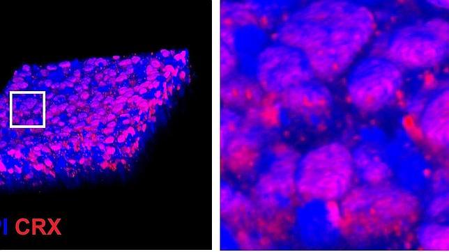 El trasplante de fotorreceptores llega para curar la degeneración macular