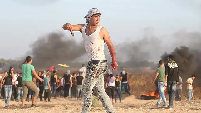 Un manifestante palestino ensangrentado tras enfrentarse con soldados israelíes en la frontera con Gaza