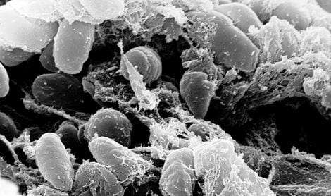 Yersinia pestis, la bacteria que causa la peste (WIKIPEDIA)