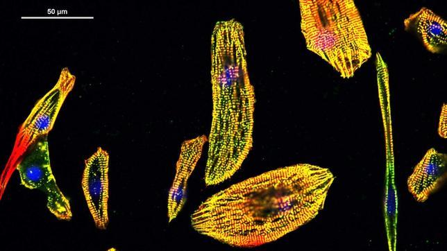 Las células del músculo cardíaco también son útiles en la regeneración cardiaca
