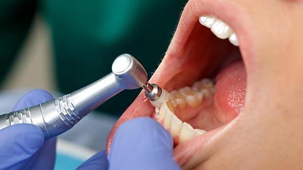 Un dentista trabaja sobre la boca de un paciente