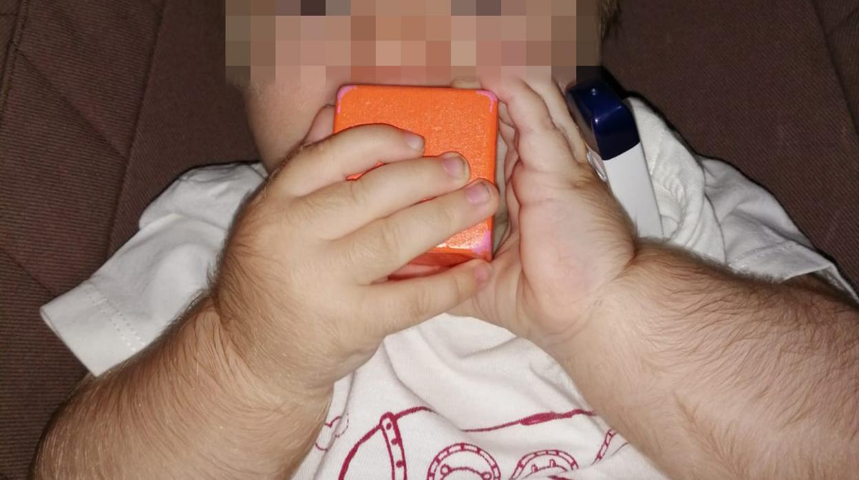 Imagen de uno de los bebés afectados por el crecepelo.