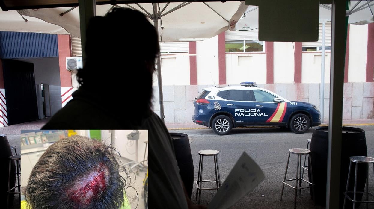 El camionero, tras denunciar en la comisaría, y la imagen de la herida en el margen inferior izquierdo