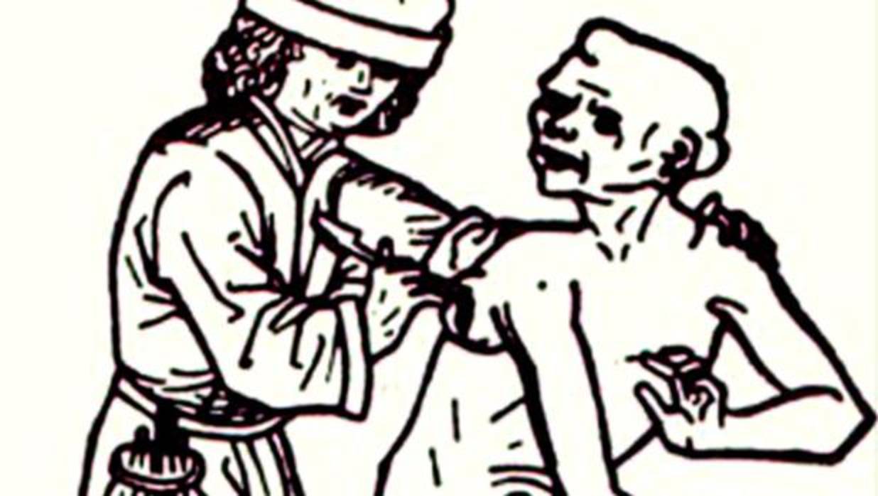 Grabado en el que se muestra a un sangrador atendiendo a un apestado