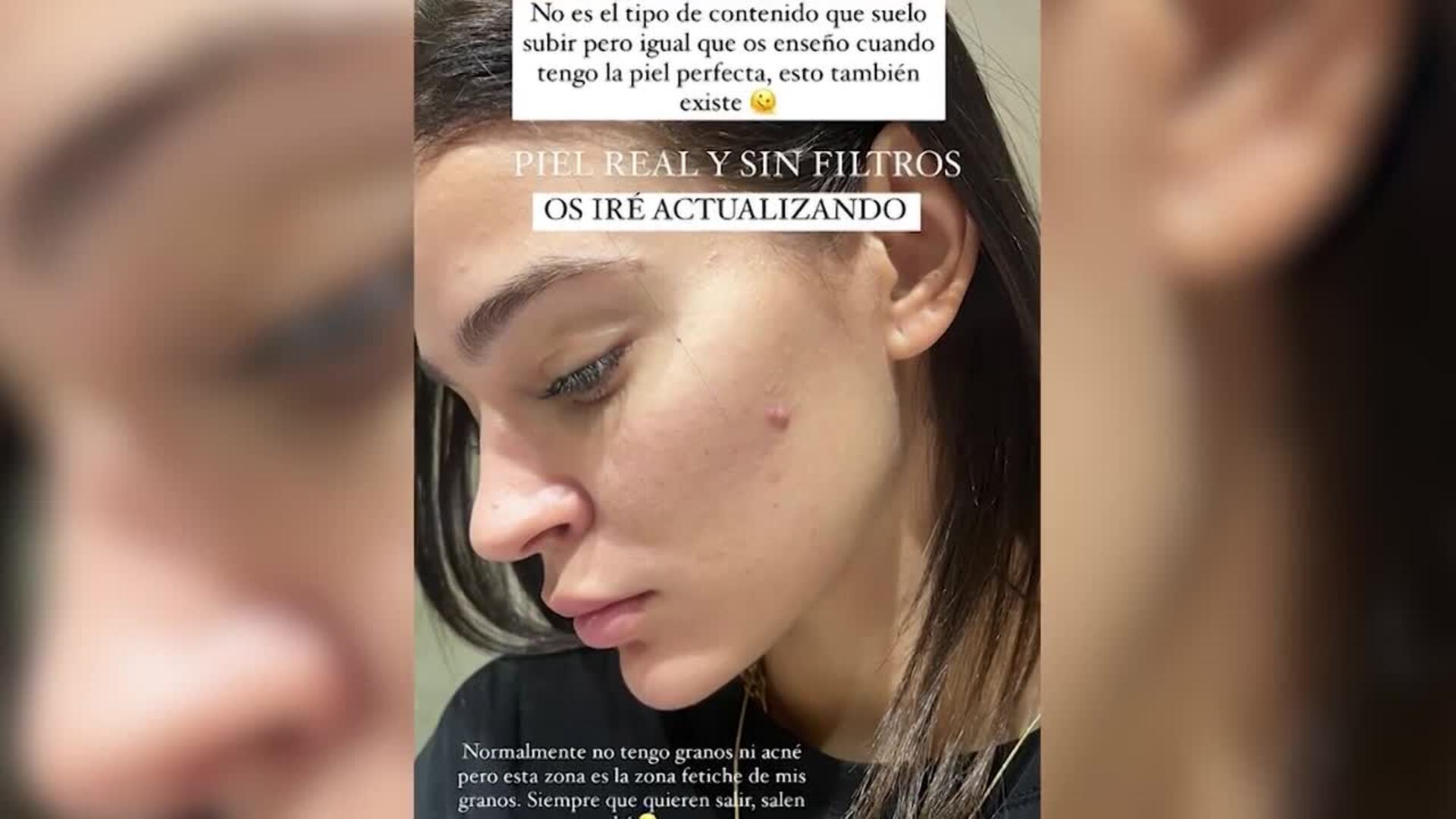 Así es la piel real de Laura Escanes: sin filtros ni maquillaje