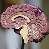 Neurofeedback, el entrenamiento del cerebro que puede ser eficaz en casos de ansiedad