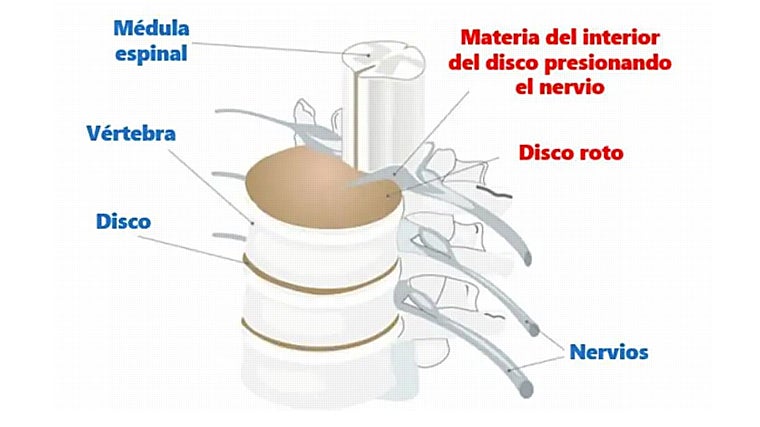 Sección de la columna vertebral