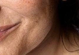 Lidia Maroñas, dermatóloga: «El error que más envejece la piel no es el sol o el tabaco, es tener una barrera cutánea alterada»