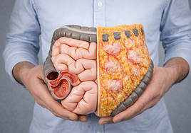Intestino permeable: qué es, por qué ocurre y cómo nos afecta