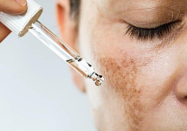 Leire Barrutia: «El mejor momento para tratar un melasma es ahora»