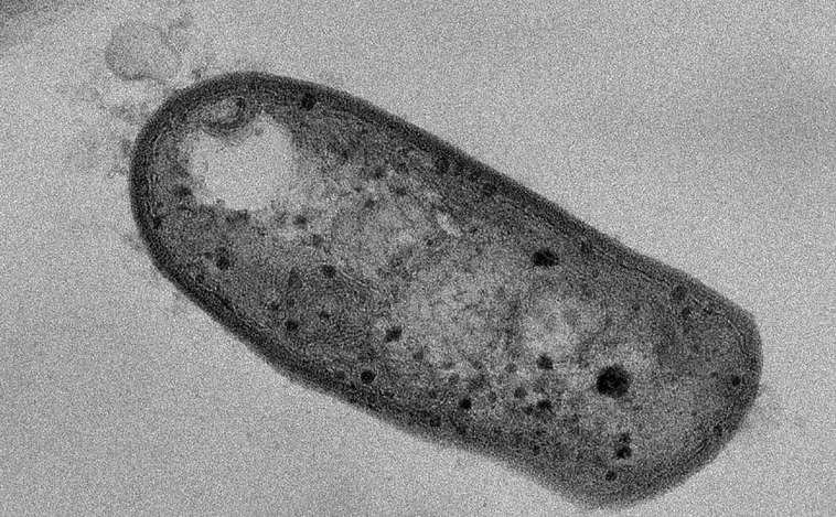 Azufre y metano, el 'infernal' y atípico menú de esta bacteria