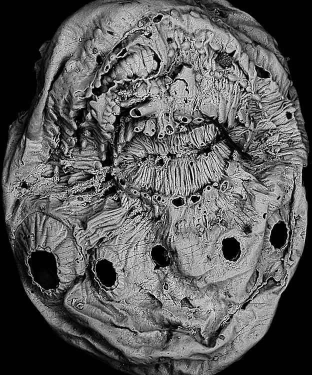 Una imagen de microscopio electrónico de barrido del Saccorhytus
