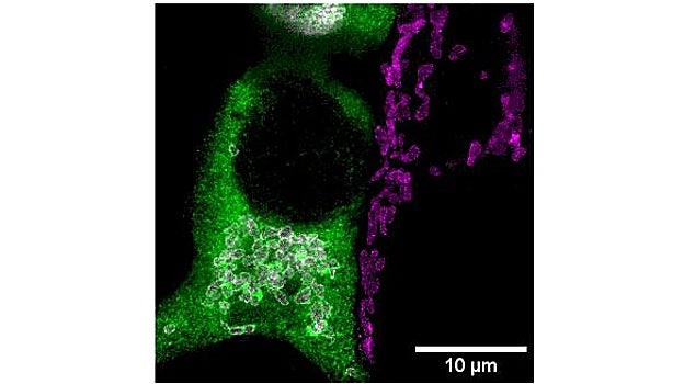 Imagen de superresolución con microscopia STED con células HEZ293 transfectadas con el transportador de zinc ZnT9 (en verde).