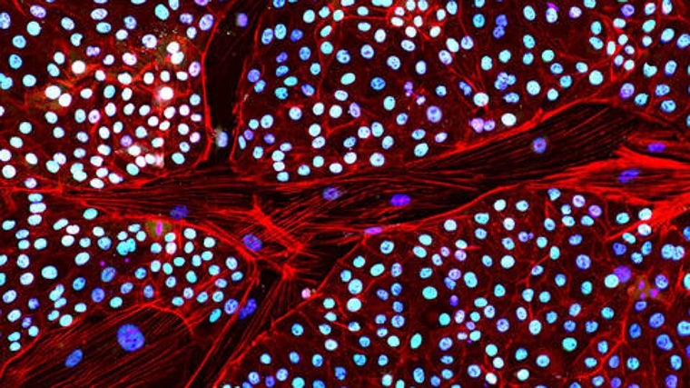 Colonias de iPSC de elefante asiático teñidas para determinar los factores de pluripotencia OCT4 (magenta) y SOX2 (verde), ADN nuclear Hoechst (azul) y proteína citoesquelética actina (rojo)