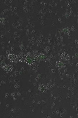 Imágenes de células con el gen de fluorescencia activado por el elemento regulador diseñado por IA