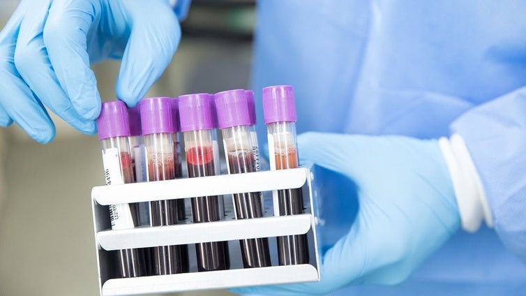 Japón desarrolla sangre artificial compatible con cualquier grupo sanguíneo