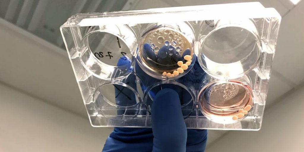La exposición al plomo afecta a la humanidad desde hace 2 millones de años y moldeó el cerebro