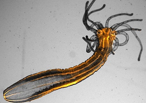 Imagem Secundária 1 – Imagem principal mostra Cassiopeia Andromeda em seu habitat natural; imagem de fluorescência de campo amplo inferior de um Nematostella vectensis adulto mostrando neurônios laranja destacados por uma linha repórter fluorescente transgênica; vista lateral: close da rede nervosa de uma anêmona, que possui uma rede densa e distribuída de neurônios por todo o corpo.