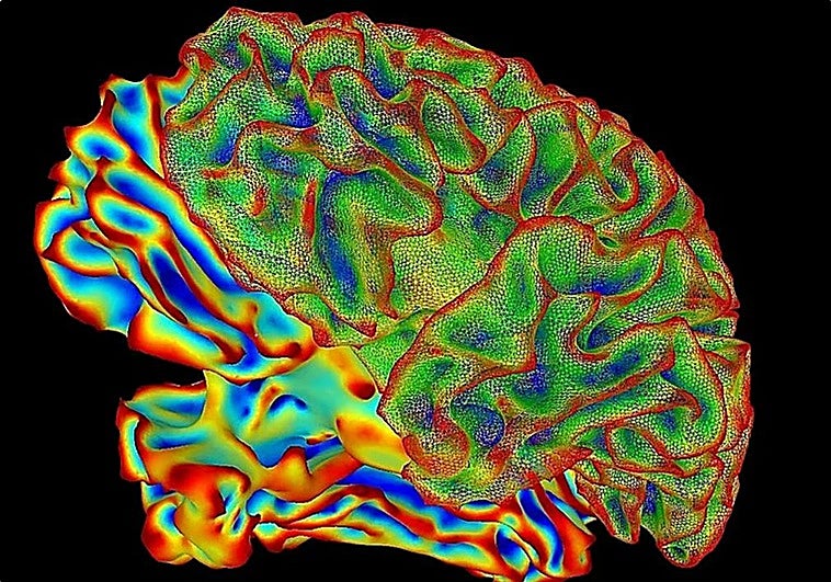 Logran poner a la muerte 'en pausa' y congelar intacto un cerebro para reactivarlo en el futuro