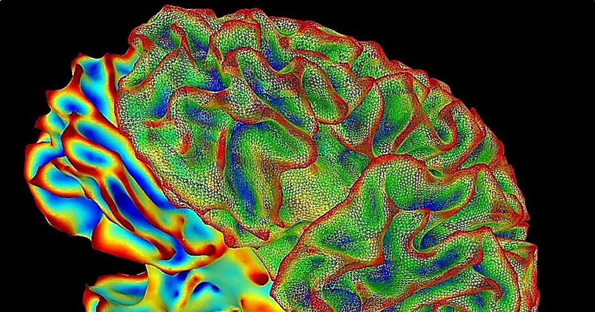 Logran poner a la muerte 'en pausa' y congelar intacto un cerebro para reactivarlo en el futuro