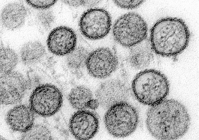 La primera secuenciación del hantavirus del MV Hondius apunta a que no ha mutado