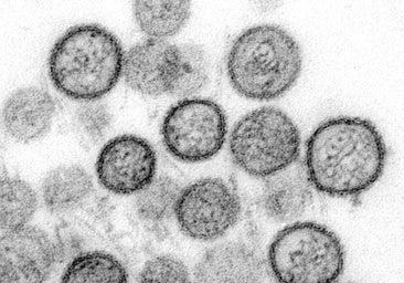 El análisis preliminar del hantavirus del MV Hondius apunta a que no ha mutado