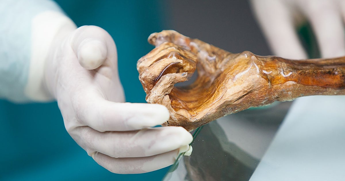 El enemigo interior de Ötzi, el hombre de hielo, que no le deja descansar en paz